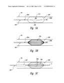 METHODS AND SYSTEMS FOR THERMALLY-INDUCED RENAL NEUROMODULATION diagram and image