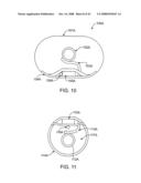 Implantable Addressable Segmented Electrodes diagram and image