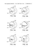 Implantable Addressable Segmented Electrodes diagram and image