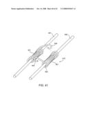 Implantable Addressable Segmented Electrodes diagram and image