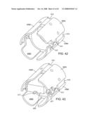 Implantable Addressable Segmented Electrodes diagram and image