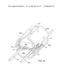 Implantable Addressable Segmented Electrodes diagram and image