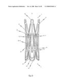 Medical device for treating a heart valve insufficiency diagram and image