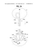 URETERAL STENT WITH CONFORMING RETENTION STRUCTURE diagram and image