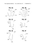 URETERAL STENT WITH CONFORMING RETENTION STRUCTURE diagram and image