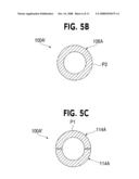 URETERAL STENT WITH CONFORMING RETENTION STRUCTURE diagram and image