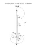 URETERAL STENT WITH CONFORMING RETENTION STRUCTURE diagram and image