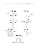 URETERAL STENT WITH CONFORMING RETENTION STRUCTURE diagram and image