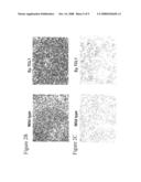 Human chronic lymphocytic leukemia modeled in mouse by targeted TCL1 expression diagram and image