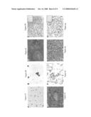 Human chronic lymphocytic leukemia modeled in mouse by targeted TCL1 expression diagram and image