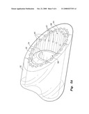 Self-cleaning and sterilizing endotracheal and tracheostomy tube diagram and image