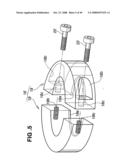 Magnetostrictive coat forming method, magnetostrictive torque sensor manufacturing method, and electric power steering apparatus employing the sensor diagram and image