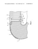 Airbag system, vehicle seat comprising an airbag system and deployment method for an airbag system diagram and image