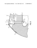 Airbag system, vehicle seat comprising an airbag system and deployment method for an airbag system diagram and image