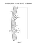 Airbag system, vehicle seat comprising an airbag system and deployment method for an airbag system diagram and image