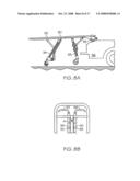 ROLL-IN COT diagram and image