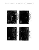 SYSTEMS AND METHODS FOR LIGHT ABSORPTION AND FIELD EMISSION USING MICROSTRUCTURED SILICON diagram and image