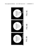 METHOD FOR PRODUCING A MAGNETIC RESONANCE IMAGE USING AN ULTRA-SHORT ECHO TIME diagram and image