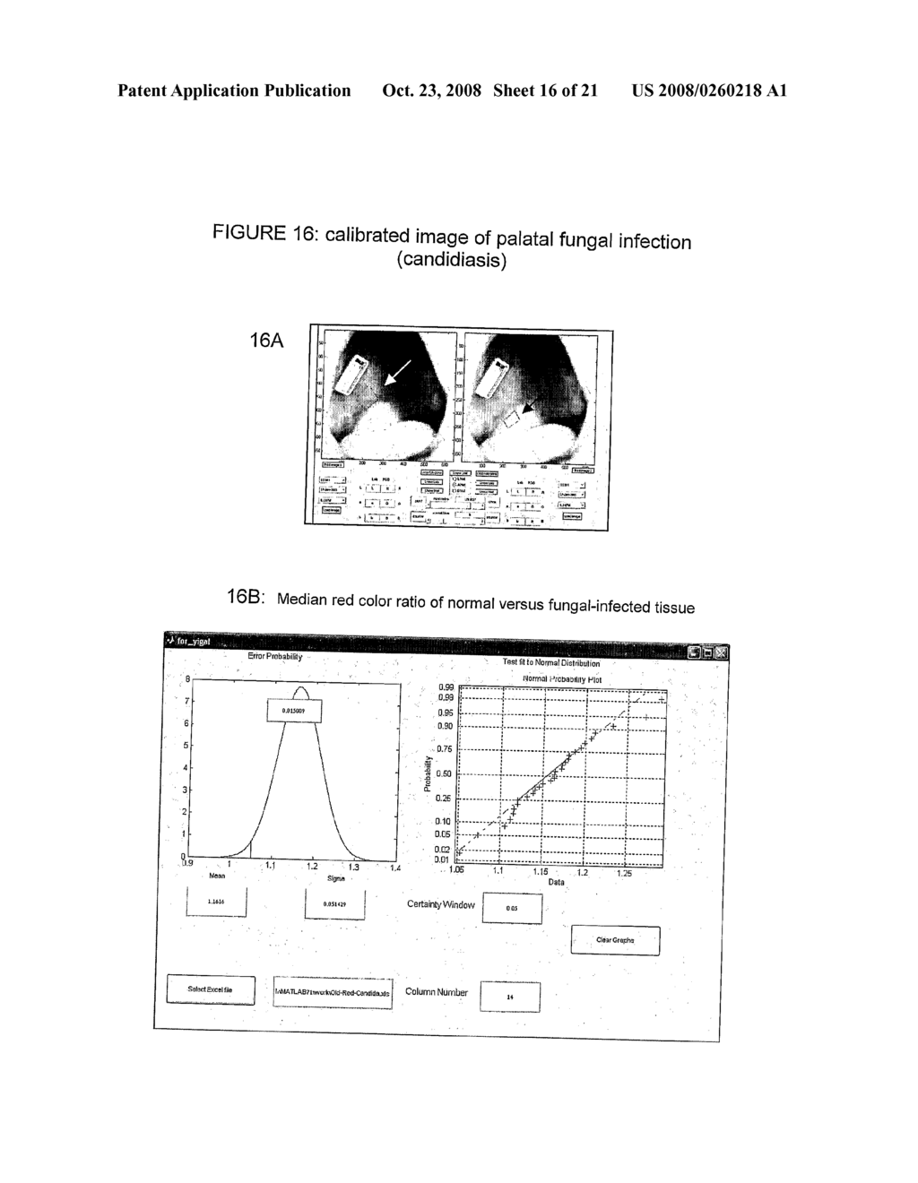 Medical Imaging Method and System - diagram, schematic, and image 17