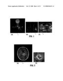 System and Method for Lesion Segmentation in Whole Body Magnetic Resonance Images diagram and image