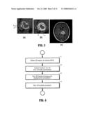 System and Method for Lesion Segmentation in Whole Body Magnetic Resonance Images diagram and image