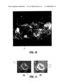 System and Method for Lesion Segmentation in Whole Body Magnetic Resonance Images diagram and image