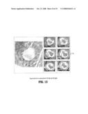 System and Method for Lesion Segmentation in Whole Body Magnetic Resonance Images diagram and image