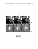 System and Method for Lesion Segmentation in Whole Body Magnetic Resonance Images diagram and image