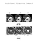 System and Method for Lesion Segmentation in Whole Body Magnetic Resonance Images diagram and image