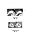 System and Method for Lesion Segmentation in Whole Body Magnetic Resonance Images diagram and image
