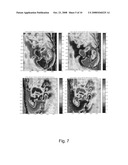 Infrared Multi-Spectral Camera and Process of Using Infrared Multi-Spectral Camera diagram and image