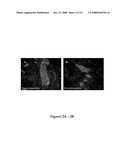 GENERATION OF PANCREATIC ENDOCRINE CELLS FROM PRIMARY DUCT CELL CULTURES AND METHODS OF USE FOR TREATMENT OF DIABETES diagram and image