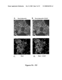 GENERATION OF PANCREATIC ENDOCRINE CELLS FROM PRIMARY DUCT CELL CULTURES AND METHODS OF USE FOR TREATMENT OF DIABETES diagram and image