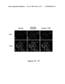 GENERATION OF PANCREATIC ENDOCRINE CELLS FROM PRIMARY DUCT CELL CULTURES AND METHODS OF USE FOR TREATMENT OF DIABETES diagram and image