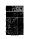 GENERATION OF PANCREATIC ENDOCRINE CELLS FROM PRIMARY DUCT CELL CULTURES AND METHODS OF USE FOR TREATMENT OF DIABETES diagram and image