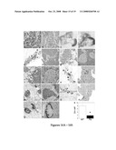 GENERATION OF PANCREATIC ENDOCRINE CELLS FROM PRIMARY DUCT CELL CULTURES AND METHODS OF USE FOR TREATMENT OF DIABETES diagram and image