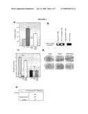 COMPOSITIONS AND METHODS FOR CHARACTERIZING, REGULATING, DIAGNOSING, AND TREATING CANCER diagram and image