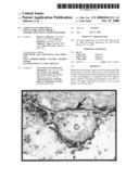 Variants in complement regulatory genes predict age-related macular degeneration diagram and image