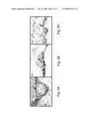 Variants in complement regulatory genes predict age-related macular degeneration diagram and image