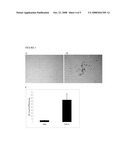 TGF-beta-MEDIATED OSTEOGENIC DIFFERENTIATION OF MESENCHYMAL STEM CELLS diagram and image