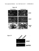 COMPOSITION AND METHOD FOR CANCER TREATMENT AND PREVENTION diagram and image