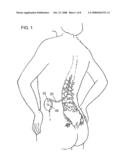 INFECTION MONITORING diagram and image