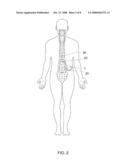 INFECTION MONITORING diagram and image