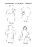 INFECTION MONITORING diagram and image