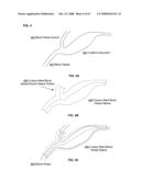 Active blood vessel sleeve methods and systems diagram and image