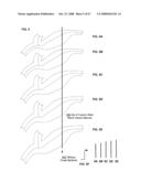 Active blood vessel sleeve methods and systems diagram and image