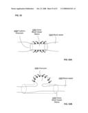 Active blood vessel sleeve methods and systems diagram and image