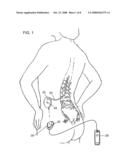 REFINED INFECTION MONITORING diagram and image