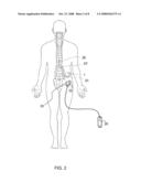 REFINED INFECTION MONITORING diagram and image