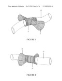 SECUREMENT DEVICE FOR SHUNT CATHETER AND IMPLANTATION METHOD THEREFOR diagram and image